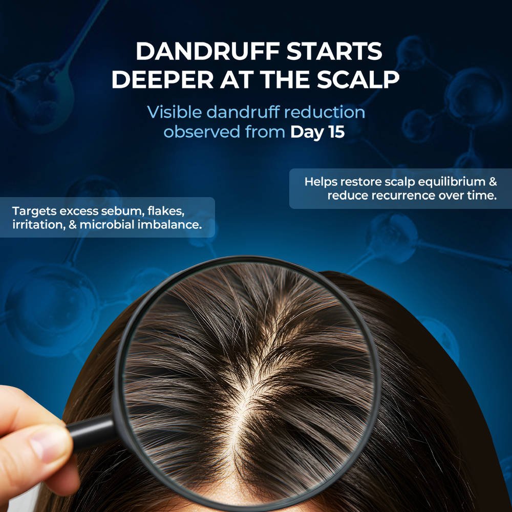 Streax Scalp Care Anti Dandruff Shampoo